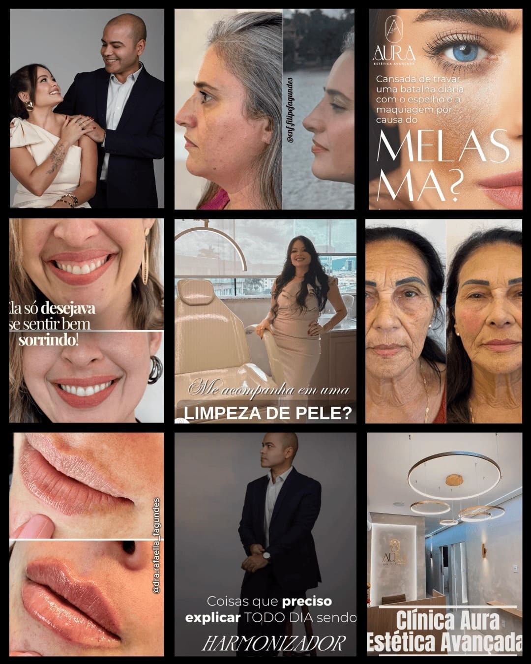 Mural de resultados da Clínica Aura no Instagram